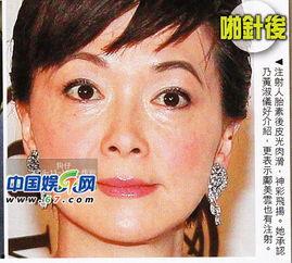 明星打人胎素,揭秘美容神话背后的真相