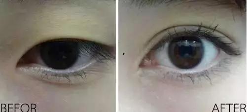 眼角内眦的明星,揭秘眼角魅力明星的秘密